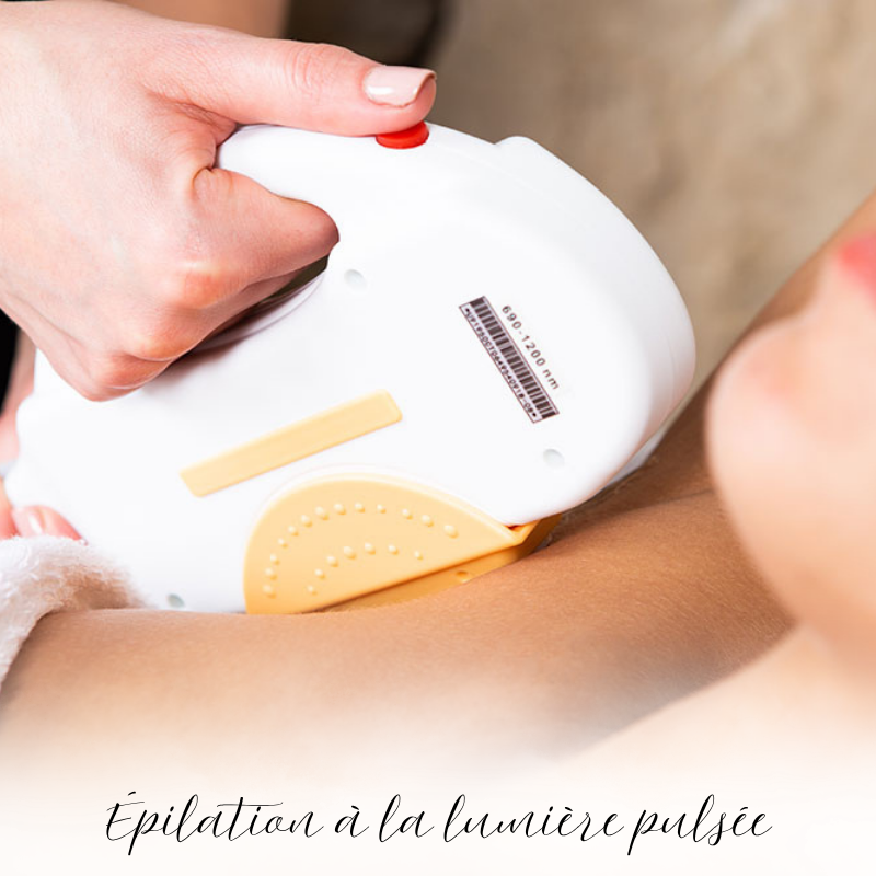 epilation lumiere pulsée à Gauchy